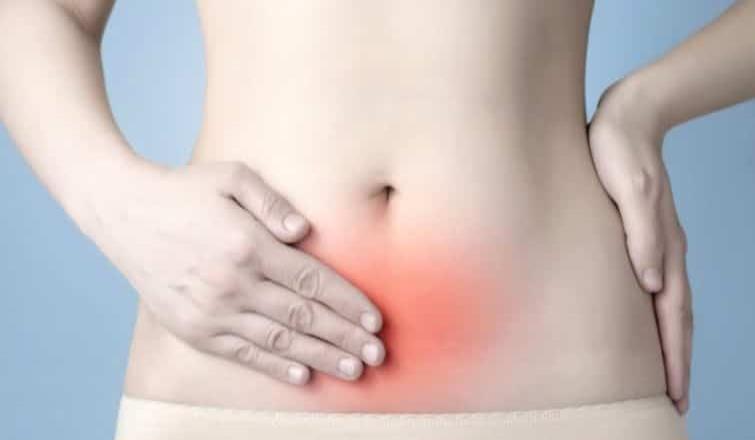 Exhorta IMSS a evitar la endometriosis