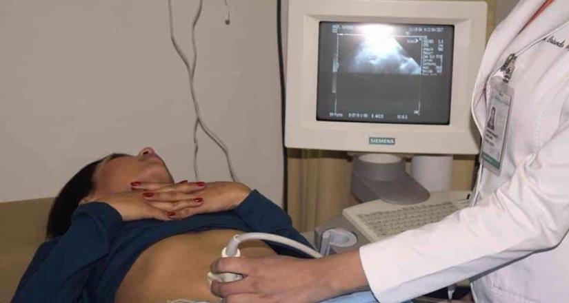 Secretaría de Salud exhorta a mujeres a detectar de forma oportuna el cáncer de ovario