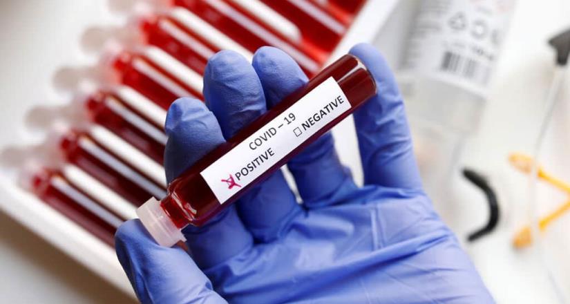 Personas de sangre tipo A tienen mayor riesgo de contraer Covid-19