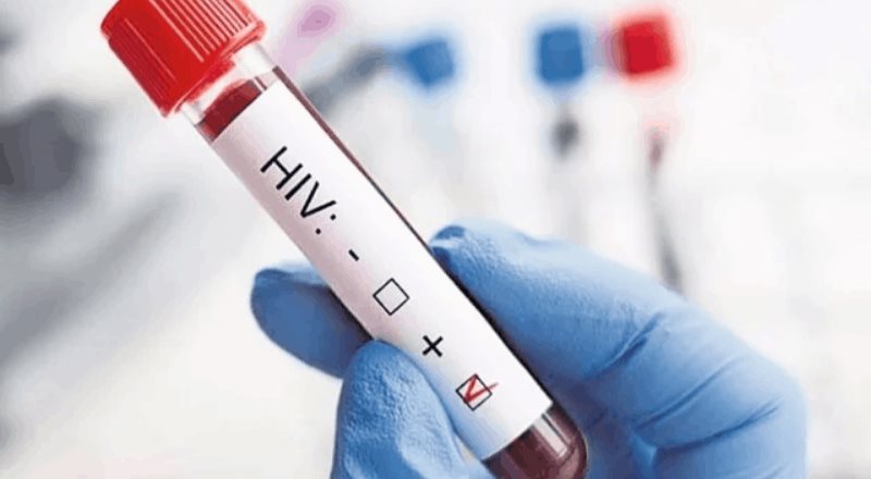 OMS alerta 73 países podrían quedarse sin fármacos contra el VIH