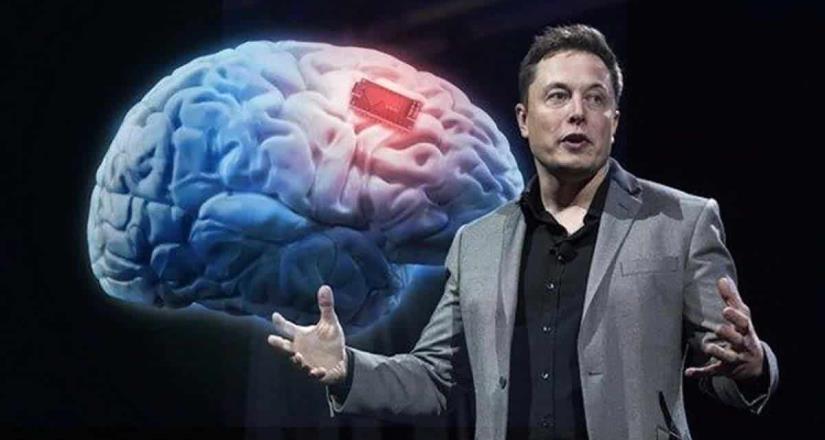 “NeuraLink”: Elon Musk presenta un chip va conectado al cerebro