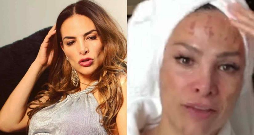 Fabiola Campomanes muestra lesiones en su rostro 