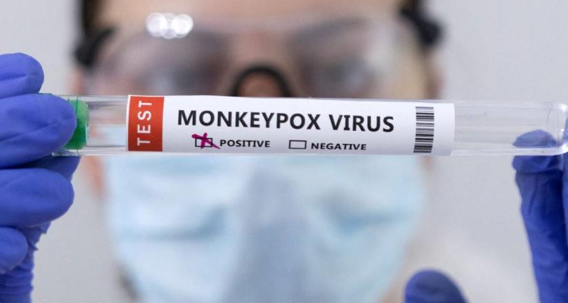 En México aumento a 48 casos de viruela del mono
