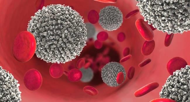 El cáncer que se esconde en la sangre: Leucemia Mieloide Aguda