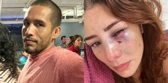 Peleadora denuncia públicamente a su ex pareja tras golpearla dejándole con notables lesiones